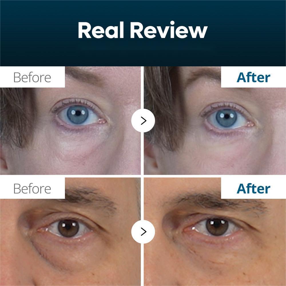 ๐ 60 seconds to results - NEGUSY Eyebag Cream