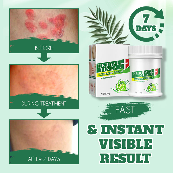 Herbal Tinealess Cream