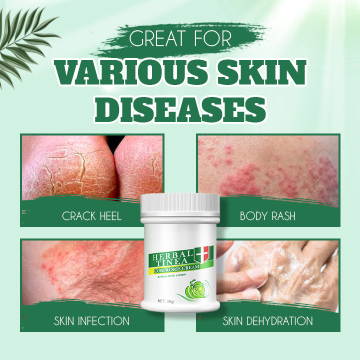 Herbal Tinealess Cream